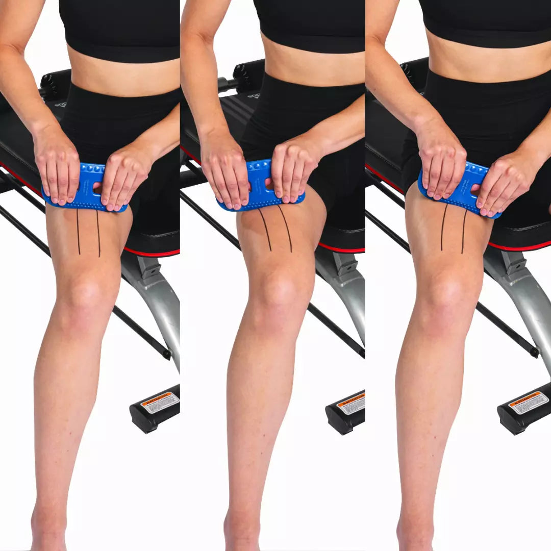 FLEXEDGE SOFT TISSUE MOBILIZER